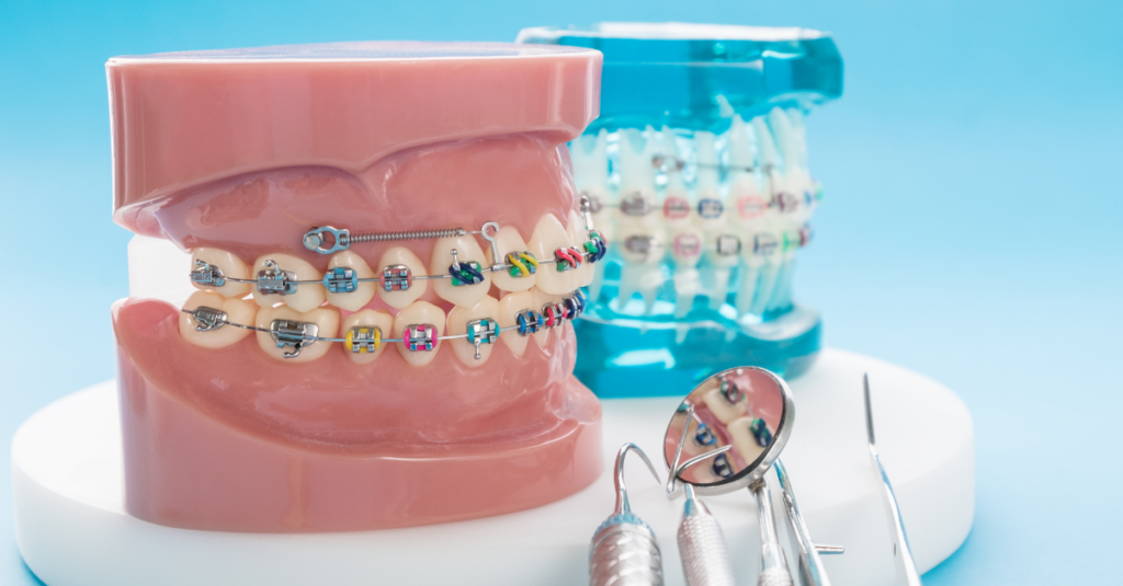 brackets