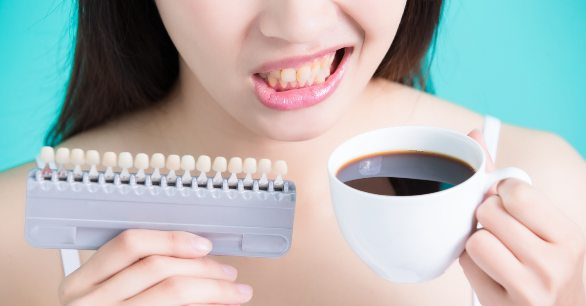 blanqueamiento dental, ventajas y beneficios amora clinica dental en sabadell