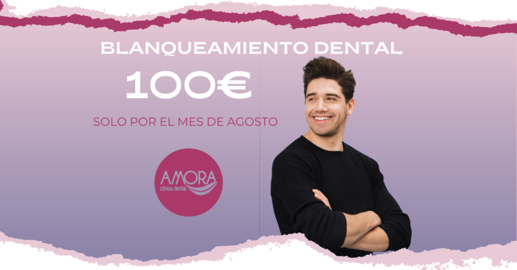 ¡ Blanqueamiento dental 100€ !