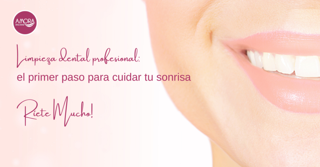 Limpieza dental profesional: el primer paso para cuidar tu sonrisa después de las fiestas