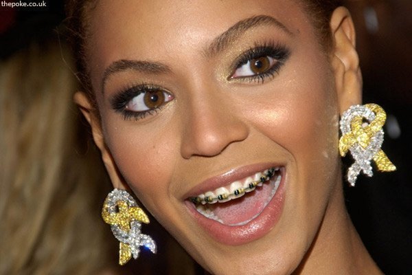 grills dentales beyonce