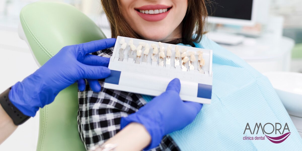 Tipos de carillas dentales