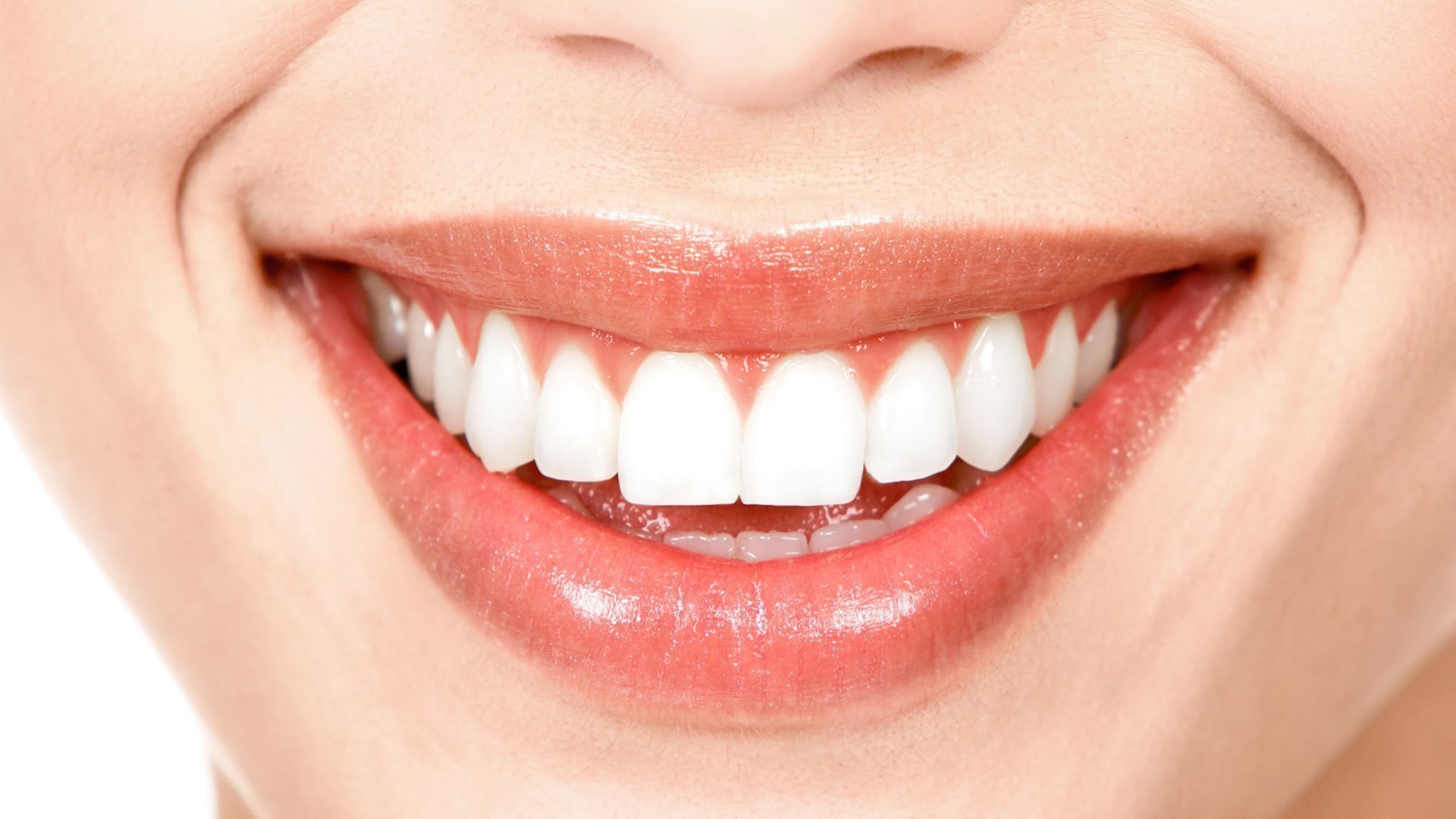 sonrisa-poderosa-amora-clinica-dental-sabadell