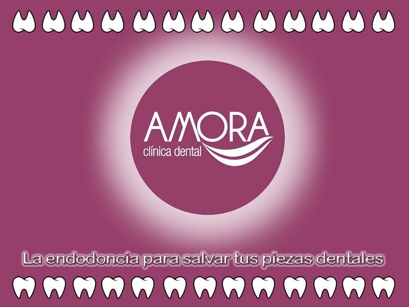 endodoncia