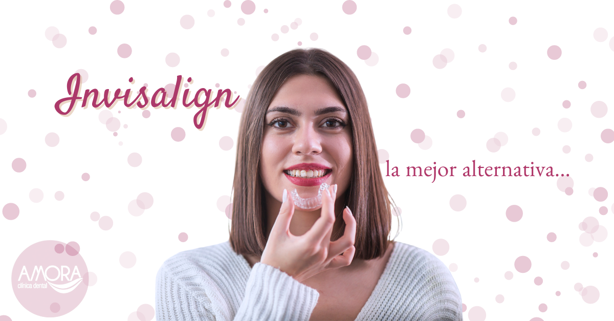 invisalign la mejor alternativa