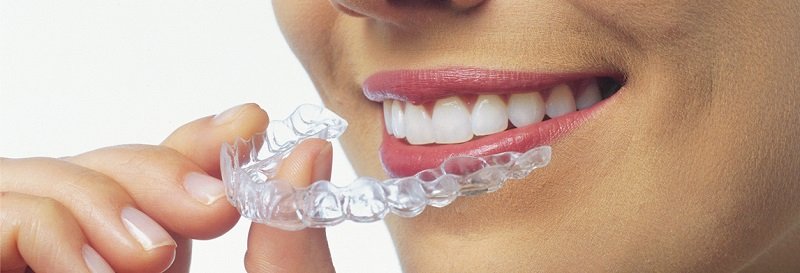 invisalign sonrisa