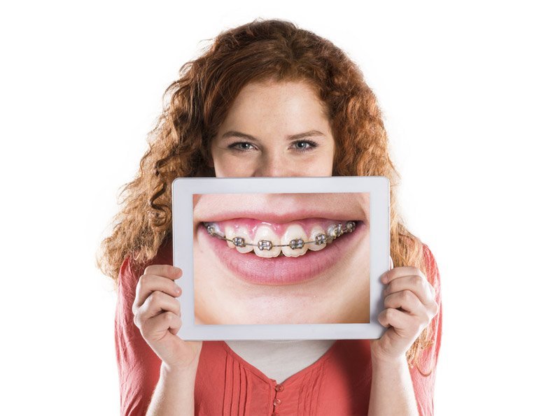servicios dentales ortodoncia Clínica Dental Sabadell