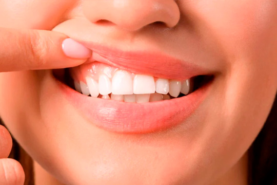 Periodoncias