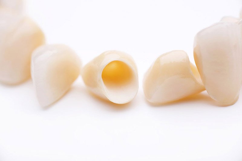 servicios dentales prótesis Clínica Dental Sabadell