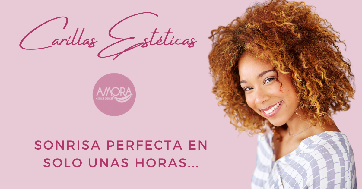 Carillas Estéticas